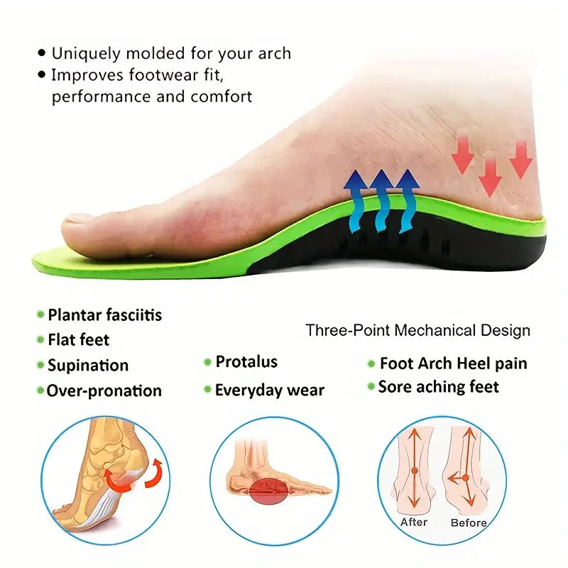 1pair Eva Orthopedic Insole, Unisex Outdoor Hiking Travel Essentials X/o Leg Correction, Flat Arch Support Sports High Elastic Cushion