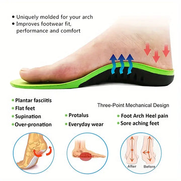 1pair Eva Orthopedic Insole, Unisex Outdoor Hiking Travel Essentials X/o Leg Correction, Flat Arch Support Sports High Elastic Cushion